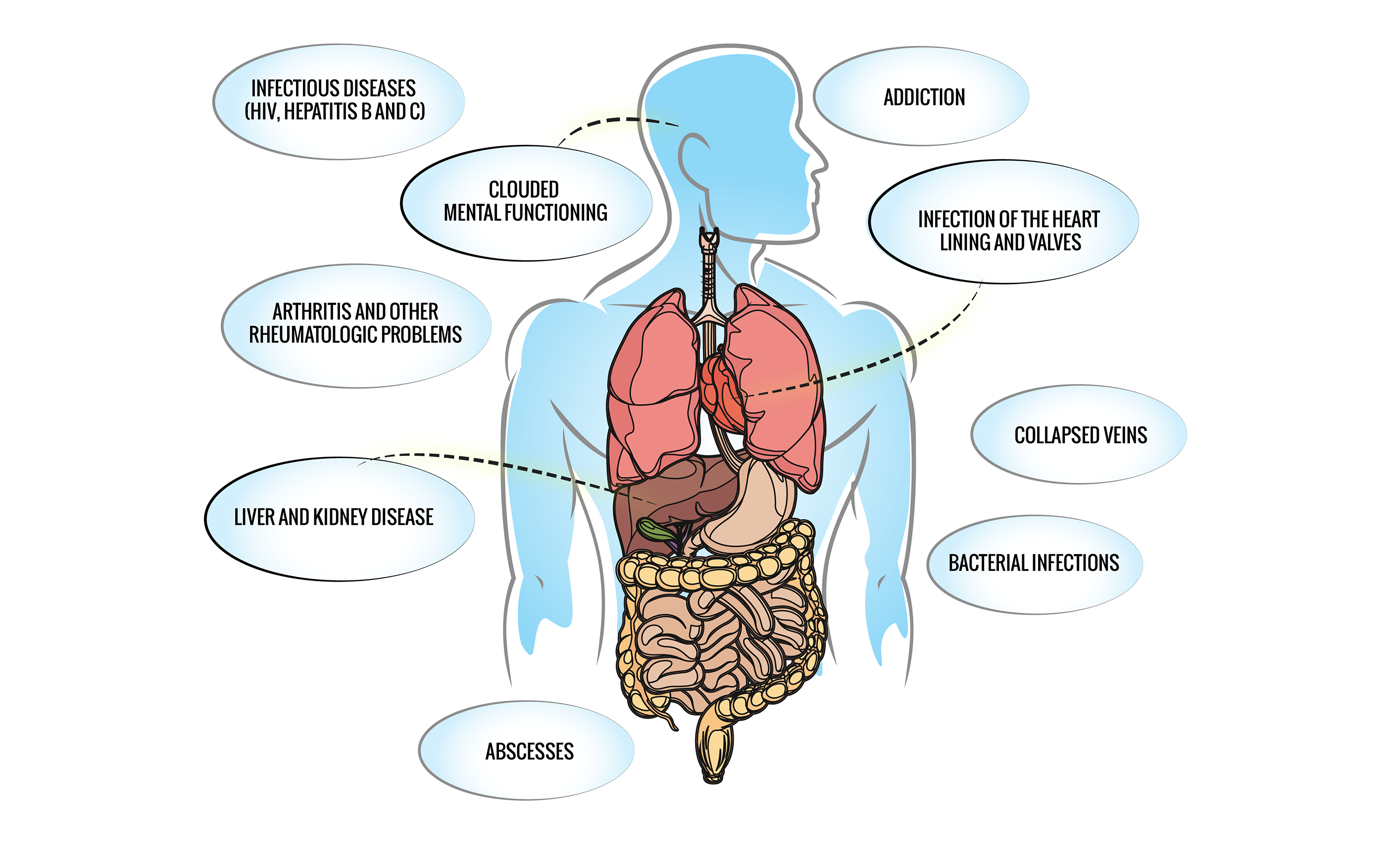 How Drugs Affect Your Looks And Your Body Just Think Twice